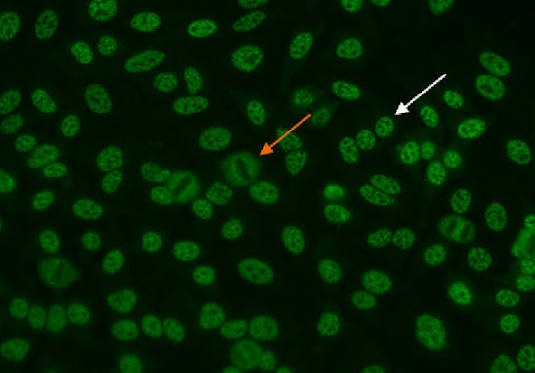 Zrnasti (speckled) obrazac fluorescencije pri testiranju ANA antitijela.