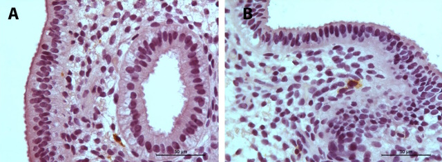 Histološki prikaz endometrija s CD56 pozitivnim uterinim NK ćelijama